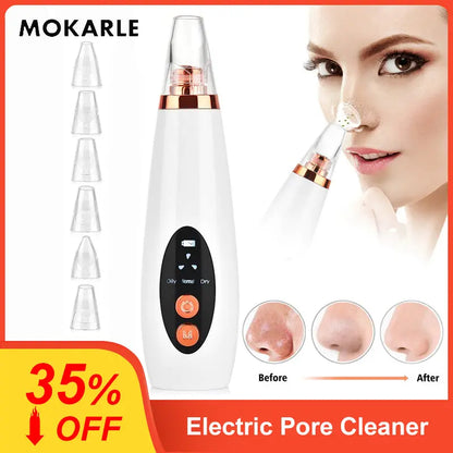 Electric Blackhead Removing Device - Vior Paris