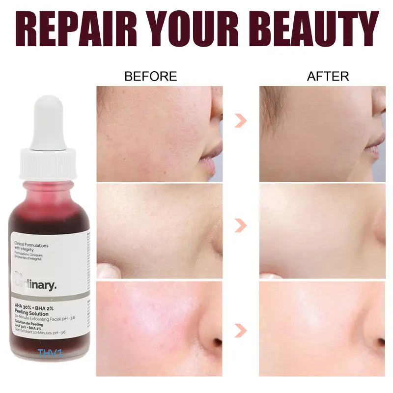 Ordinary Peeling Solution AHA 30% + BHA 2% - Vior Paris